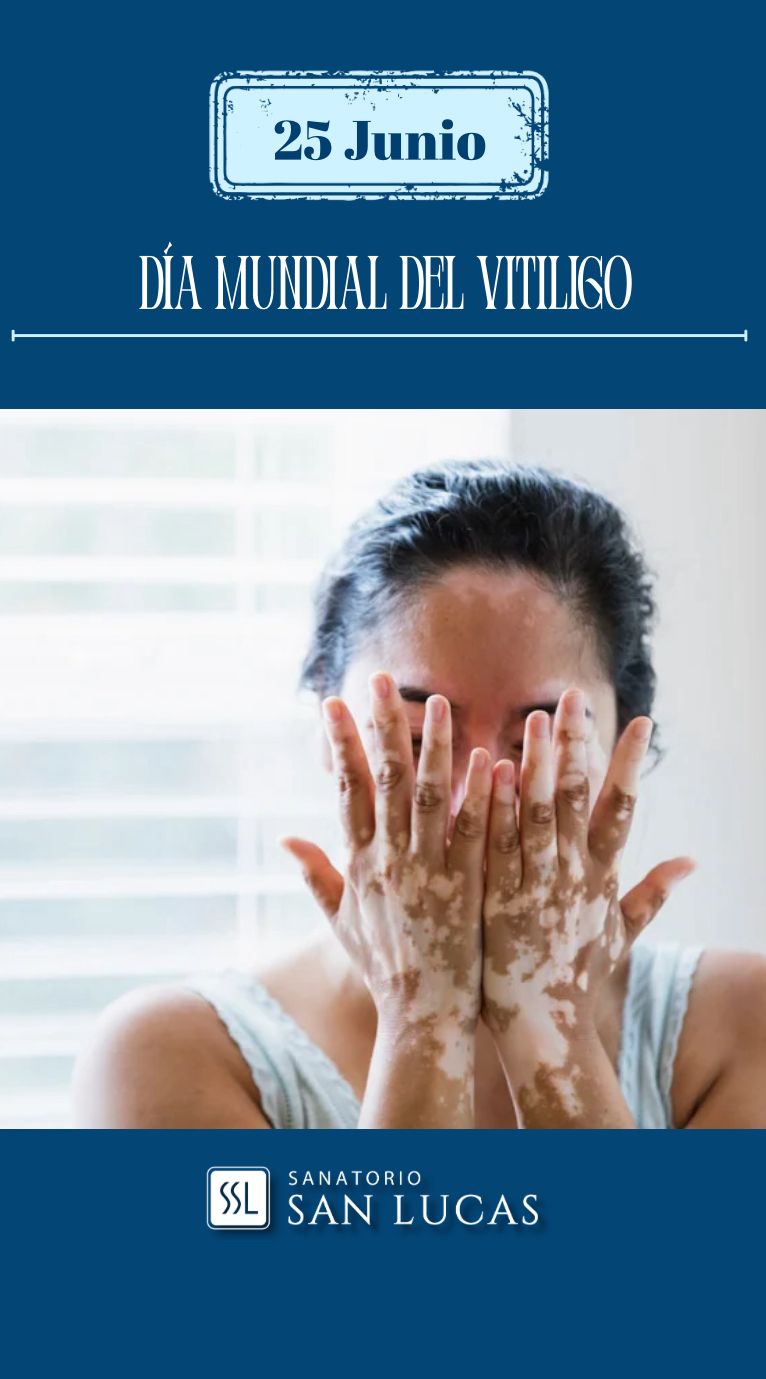 Dia mundial del Vitiligo